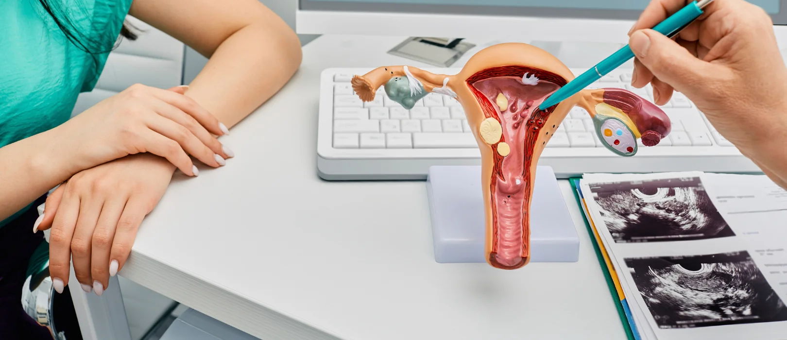 Gynaecology